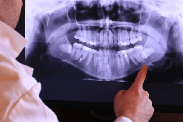 Best Chipped Tooth Repair Near Me  in Hagaman, NY